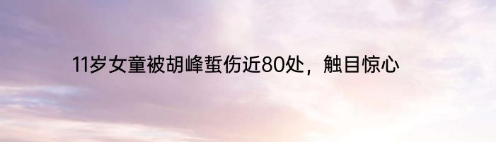 11岁女童被胡峰蜇伤近80处，触目惊心